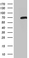PEA3 / ETV4 Antibody - HEK293T cells were transfected with the pCMV6-ENTRY control. (Left lane) or pCMV6-ENTRY ETV4. (Right lane) cDNA for 48 hrs and lysed