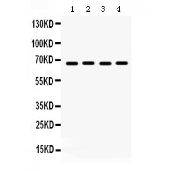 PEA3 / ETV4 Antibody - Pea3 antibody Western blot. All lanes: Anti Pea3 at 0.5 ug/ml. Lane 1: Rat Lung Tissue Lysate at 50 ug. Lane 2: HELA Whole Cell Lysate at 40 ug. Lane 3: A549 Whole Cell Lysate at 40 ug. Lane 4: SW620 Whole Cell Lysate at 40 ug. Predicted band size: 68 kD. Observed band size: 68 kD.