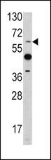 PEA3 / ETV4 Antibody - Western blot of ETV4 antibody in mouse heart tissue lysates (35 ug/lane). ETV4 (arrow) was detected using the purified antibody.