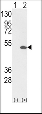PEA3 / ETV4 Antibody - Western blot of ETV4 (arrow) using rabbit polyclonal ETV4 Antibody (RB20008). 293 cell lysates (2 ug/lane) either nontransfected (Lane 1) or transiently transfected with the ETV4 gene (Lane 2).