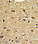 PEA3 / ETV4 Antibody - Formalin-fixed and paraffin-embedded human brain tissue reacted with ETV4 Antibody , which was peroxidase-conjugated to the secondary antibody, followed by DAB staining. This data demonstrates the use of this antibody for immunohistochemistry; clinical relevance has not been evaluated.