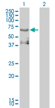 PEA3 / ETV4 Antibody - Western Blot analysis of ETV4 expression in transfected 293T cell line by ETV4 monoclonal antibody (M01), clone 3G9-1B9.Lane 1: ETV4 transfected lysate(54 KDa).Lane 2: Non-transfected lysate.