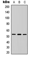 PEA3 / ETV4 Antibody - Western blot analysis of ETV4 expression in HeLa (A); Raw264.7 (B); PC12 (C) whole cell lysates.