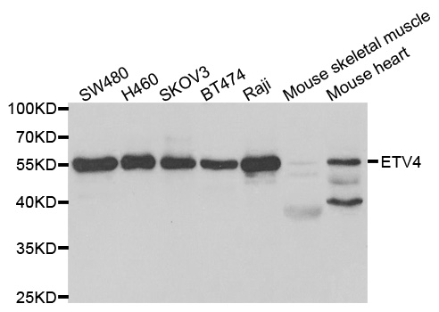 PEA3 / ETV4 Antibody - Western blot analysis of extracts of various cell lines, using ETV4 antibody.