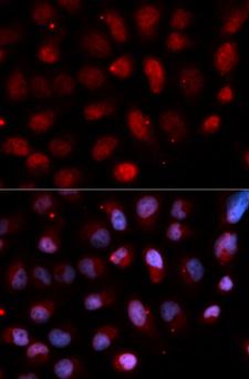 PEA3 / ETV4 Antibody - Immunofluorescence analysis of U20S cell using ETV4 antibody. Blue: DAPI for nuclear staining.