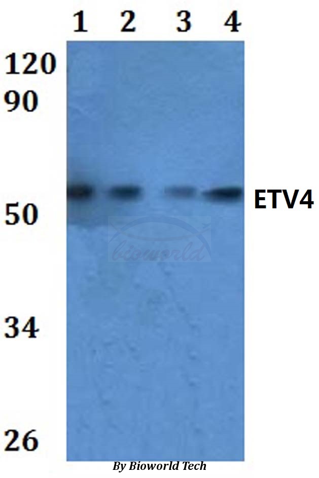 PEA3 / ETV4 Antibody - Western blot of ETV4 antibody at 1:500 dilution. Lane 1: HEK293T whole cell lysate.