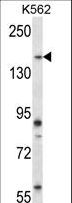 PEAK1 / SGK269 Antibody - Mouse Sgk269 Antibody western blot of K562 cell line lysates (35 ug/lane). The Sgk269 antibody detected the Sgk269 protein (arrow).