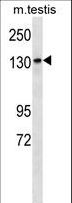PEAK1 / SGK269 Antibody - Mouse Sgk269 Antibody western blot of mouse testis tissue lysates (35 ug/lane). The Sgk269 antibody detected the Sgk269 protein (arrow).