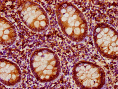 PEAK1 / SGK269 Antibody - Immunohistochemistry Dilution at 1:200 and staining in paraffin-embedded human appendix tissue performed on a Leica BondTM system. After dewaxing and hydration, antigen retrieval was mediated by high pressure in a citrate buffer (pH 6.0). Section was blocked with 10% normal Goat serum 30min at RT. Then primary antibody (1% BSA) was incubated at 4°C overnight. The primary is detected by a biotinylated Secondary antibody and visualized using an HRP conjugated SP system.