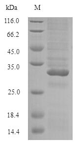 Conglutin Protein - (Tris-Glycine gel) Discontinuous SDS-PAGE (reduced) with 5% enrichment gel and 15% separation gel.