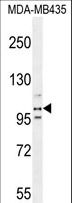 PEAR1 Antibody - PEAR1 Antibody western blot of MDA-MB435 cell line lysates (35 ug/lane). The PEAR1 antibody detected the PEAR1 protein (arrow).