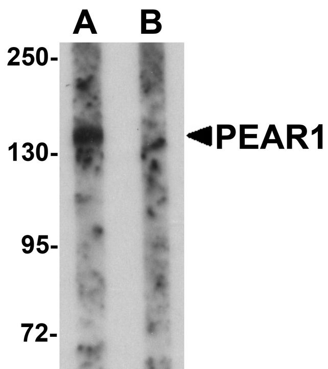 PEAR1 Antibody - Western blot analysis of PEAR1 in rat kidney tissue lysate with PEAR1 antibody at 1 ug/ml in (A) the absence and (B) the presence of blocking peptide.
