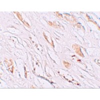 PEAR1 Antibody - Immunohistochemistry of PEAR1 in human kidney tissue with PEAR1 antibody at 2.5 µg/mL.