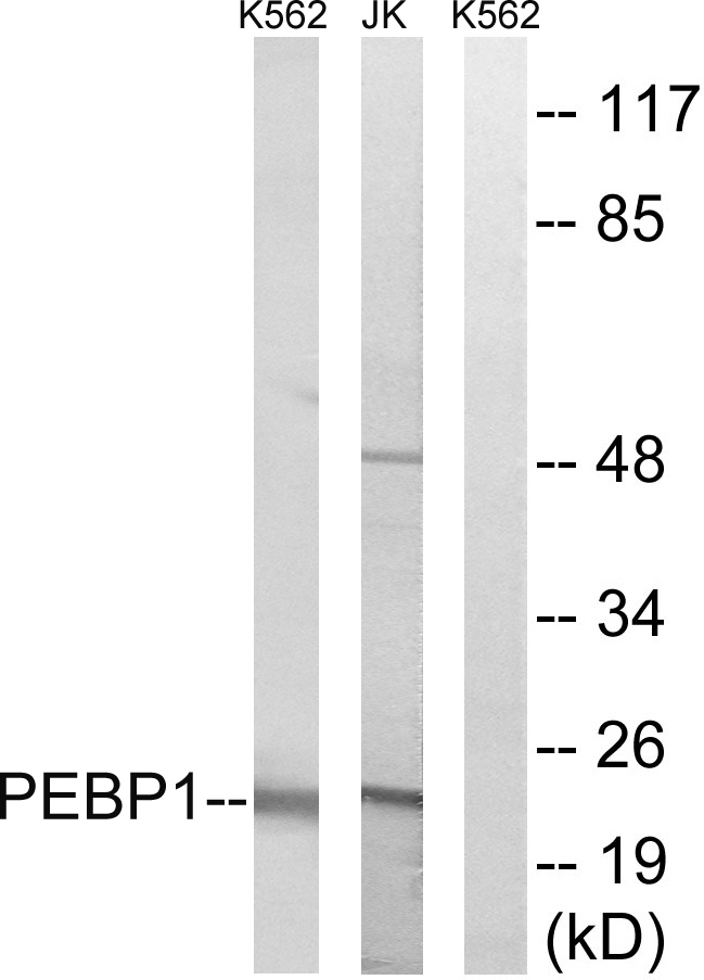 PEBP1 / RKIP Antibody - Western blot analysis of lysates from Jurkat and K562 cells, using PEBP1 Antibody. The lane on the right is blocked with the synthesized peptide.