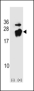 PEBP1 / RKIP Antibody - Western blot of PBP (arrow) using rabbit polyclonal PBP Antibody (A152). 293 cell lysates (2 ug/lane) either nontransfected (Lane 1) or transiently transfected (Lane 2) with the PBP gene.
