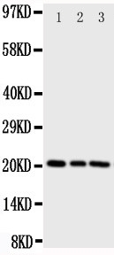 PEBP1 / RKIP Antibody - Anti-PBP antibody, Western blotting All lanes: Anti PBP at 0.5ug/ml Lane 1: Rat Brain Tissue Lysate at 50ug Lane 2: Rat Lung Tissue Lysate at 50ug Lane 3: Rat Liver Tissue Lysate at 50ug Predicted bind size: 21KD Observed bind size: 21KD