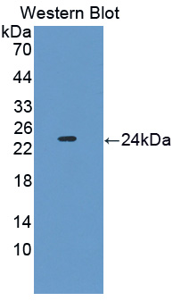 PEBP1 / RKIP Antibody - Western blot of PEBP1 / RKIP antibody.