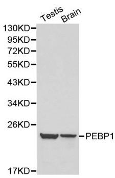 PEBP1 / RKIP Antibody - Western blot of PEBP1 pAb in extracts from mouse testis and brain tissues.