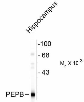 PEBP1 / RKIP Antibody - Western Blot of PEBP1 antibody. Western blot of rat brain lysate showing the specific immunolabeling of ~ 22k PEBP protein
