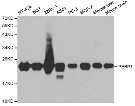 PEBP1 / RKIP Antibody - Western blot analysis of extracts of various cell lines, using PEBP1 antibody at 1:1000 dilution. The secondary antibody used was an HRP Goat Anti-Rabbit IgG (H+L) at 1:10000 dilution. Lysates were loaded 25ug per lane and 3% nonfat dry milk in TBST was used for blocking. An ECL Kit was used for detection and the exposure time was 10s.