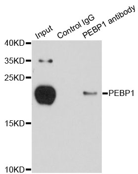 PEBP1 / RKIP Antibody - Immunoprecipitation analysis of 150ug extracts of MCF-7 cells using 3ug PEBP1 antibody. Western blot was performed from the immunoprecipitate using PEBP1 antibodyat a dilition of 1:500.