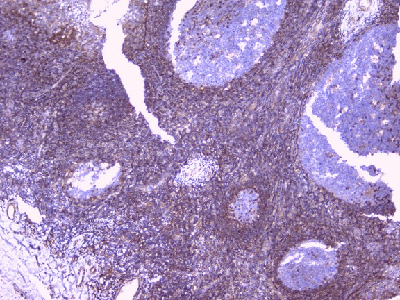 PEBP1 / RKIP Antibody - IHC analysis of PBP using anti-PBP antibody. PBP was detected in paraffin-embedded section of human tonsil tissue. Heat mediated antigen retrieval was performed in citrate buffer (pH6, epitope retrieval solution) for 20 mins. The tissue section was blocked with 10% goat serum. The tissue section was then incubated with 1µg/ml rabbit anti-PBP Antibody overnight at 4°C. Biotinylated goat anti-rabbit IgG was used as secondary antibody and incubated for 30 minutes at 37°C. The tissue section was developed using Strepavidin-Biotin-Complex (SABC) with DAB as the chromogen.