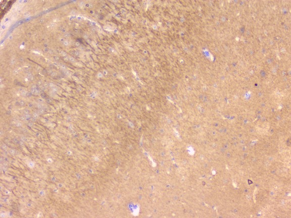 PEBP1 / RKIP Antibody - IHC analysis of PBP using anti-PBP antibody. PBP was detected in paraffin-embedded section of mouse brain tissue. Heat mediated antigen retrieval was performed in citrate buffer (pH6, epitope retrieval solution) for 20 mins. The tissue section was blocked with 10% goat serum. The tissue section was then incubated with 1µg/ml rabbit anti-PBP Antibody overnight at 4°C. Biotinylated goat anti-rabbit IgG was used as secondary antibody and incubated for 30 minutes at 37°C. The tissue section was developed using Strepavidin-Biotin-Complex (SABC) with DAB as the chromogen.