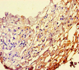 PEBP1 / RKIP Antibody - Immunohistochemistry of paraffin-embedded human thyroid tissue at dilution of 1:100