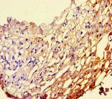 PEBP1 / RKIP Antibody - Immunohistochemistry of paraffin-embedded human thyroid tissue at dilution of 1:100