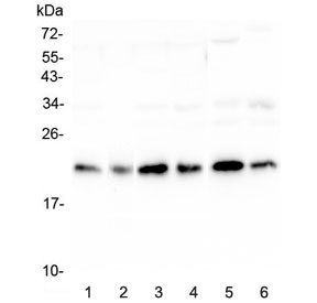 PEBP1 / RKIP Antibody - Western blot testing of human 1) HeLa, 2) placenta, 3) HepG2, 4) MCF7, 5) mouse testis and 6) mouse brain lysate with RKIP antibody at 0.5ug/ml. Predicted molecular weight ~21 kDa.