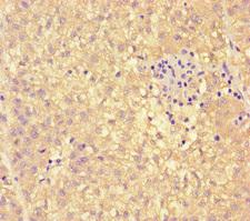 PEBP4 Antibody - Immunohistochemistry of paraffin-embedded human liver cancer at dilution of 1:100
