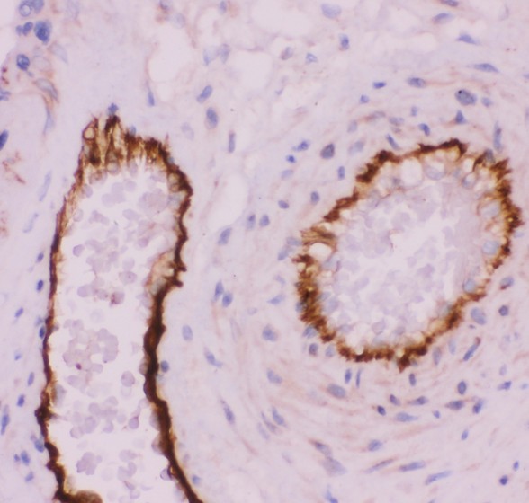 PECAM-1 / CD31 Antibody - CD31 antibody IHC-paraffin: Human Placenta Tissue.