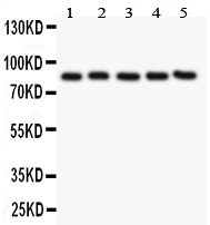 PECAM-1 / CD31 Antibody - Western blot analysis of CD31 using anti-CD31 antibody. Electrophoresis was performed on a 5-20% SDS-PAGE gel at 70V (Stacking gel) / 90V (Resolving gel) for 2-3 hours. The sample well of each lane was loaded with 50ug of sample under reducing conditions. lane 1: HELA whole cell lysate, lane 2: U937 whole cell lysate, lane 3: MM231 whole cell lysate, lane 4: JURKAT whole cell lysate, lane 5: RAJI whole cell lysate. After Electrophoresis, proteins were transferred to a Nitrocellulose membrane at 150mA for 50-90 minutes. Blocked the membrane with 5% Non-fat Milk/ TBS for 1.5 hour at RT. The membrane was incubated with rabbit anti-CD31 antigen affinity purified polyclonal antibody at 0.5 µg/mL overnight at 4°C, then washed with TBS-0.1% Tween 3 times with 5 minutes each and probed with a goat anti-rabbit IgG-HRP secondary antibody at a dilution of 1:10000 for 1.5 hour at RT. The signal is developed using an Enhanced Chemiluminescent detection (ECL) kit with Tanon 5200 system. A specific band was detected for CD31 at approximately 82KD. The expected band size for CD31 is at 82KD.