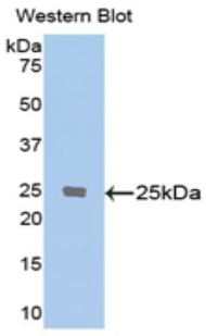 PECAM-1 / CD31 Antibody - Western blot of recombinant PECAM-1 / CD31.  This image was taken for the unconjugated form of this product. Other forms have not been tested.