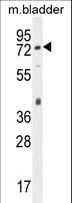 PECAM-1 / CD31 Antibody - Mouse CD31 Antibody western blot of mouse bladder tissue lysates (35 ug/lane). The MouseCD31 antibody detected the MouseCD31 protein (arrow).