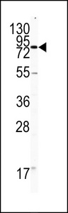 PECAM-1 / CD31 Antibody - Western blot of CD31 antibody in HL60 cell line lysates (35 ug/lane). CD31 (arrow) was detected using the purified antibody.