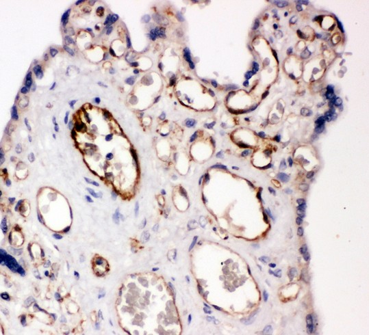 PECAM-1 / CD31 Antibody - CD31 antibody IHC-paraffin: Human Placenta Tissue.