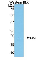 PECAM-1 / CD31 Antibody - Western Blot; Sample: Recombinant protein.