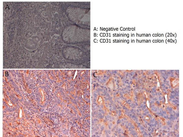PECAM-1 / CD31 Antibody - Immunohistochemistry with anti-CD31 antibody showing CD31 staining of vascular endothelium in human colon at 20x and 40x (B & C). Formalin fixed/paraffin embedded sections were subjected to heat induced epitope retrieval (HIER) at pH 6.2 and then incubated with rabbit anti-human CD31 antibody at 4.0 µg/ml for 60 minutes. The reaction was developed using MACH 1 universal HRP polymer detection system and visualized with 3’3-diamino-benzidine substrate (DAB).