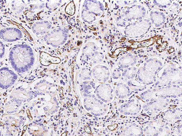 PECAM-1 / CD31 Antibody - immunochemical staining of human CD31 in human stomach with rabbit monoclonal antibody at 1:300 dilution, formalin-fixed paraffin embedded sections.