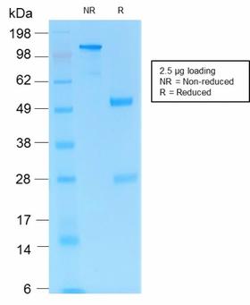 PECAM-1 / CD31 Antibody - SDS-PAGE Analysis Purified CD31 Rabbit Recombinant Monoclonal Antibody (C31/1395R). Confirmation of Purity and Integrity of Antibody.