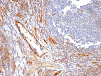 PECAM-1 / CD31 Antibody - Formalin-fixed, paraffin-embedded human tonsil stained with CD31 antibody (C31.10).  This image was taken for the unmodified form of this product. Other forms have not been tested.