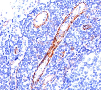 PECAM-1 / CD31 Antibody - CD31 antibody C31.3 immunohistochemistry tonsil.  This image was taken for the unmodified form of this product. Other forms have not been tested.