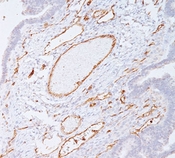 PECAM-1 / CD31 Antibody - PECAM-1 antibody C31.7 immunohistochemistry colon carcinoma.  This image was taken for the unmodified form of this product. Other forms have not been tested.
