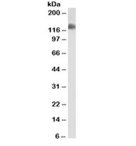 PECAM-1 / CD31 Antibody - Western blot testing of ThP1 cell lysate with CD31 antibody (clone JC/70A). Predicted size: 83-130KD depending on level of glycosylation. This image was taken for the unmodified form of this product. Other forms have not been tested.
