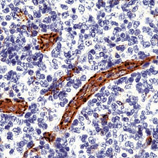 PECAM-1 / CD31 Antibody - Formalin-fixed, paraffin-embedded human tonsil stained with CD31 antibody.