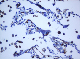 PECAM-1 / CD31 Antibody - IHC of paraffin-embedded Human lung tissue using anti-PECAM1 mouse monoclonal antibody. (Heat-induced epitope retrieval by 10mM citric buffer, pH6.0, 120°C for 3min).