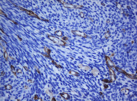 PECAM-1 / CD31 Antibody - IHC of paraffin-embedded Human Ovary tissue using anti-PECAM1 mouse monoclonal antibody. (Heat-induced epitope retrieval by 10mM citric buffer, pH6.0, 120°C for 3min).