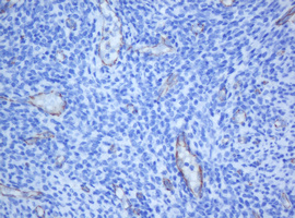 PECAM-1 / CD31 Antibody - IHC of paraffin-embedded Human endometrium tissue using anti-PECAM1 mouse monoclonal antibody. (Heat-induced epitope retrieval by 10mM citric buffer, pH6.0, 120°C for 3min).
