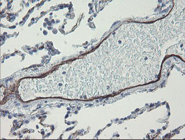 PECAM-1 / CD31 Antibody - IHC of paraffin-embedded Human lung tissue using anti-PECAM1 mouse monoclonal antibody.